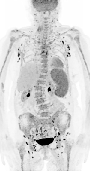 The X-ray scanner is used to investigate a discrepancy in sex